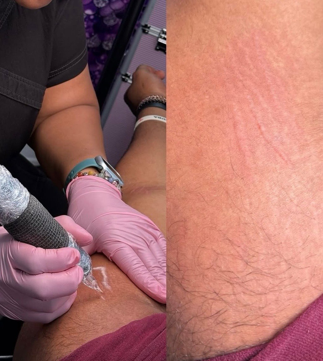 Inkless Scar Camouflage